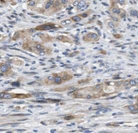Neuroglobin Antibody - BSA Free