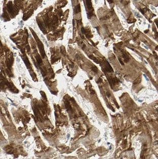 NAV1 Antibody - BSA Free