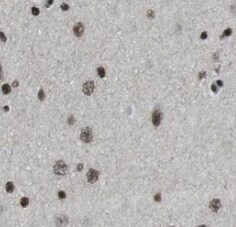 Neuromedin B Antibody - BSA Free