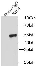 NEU4 Antibody - BSA Free