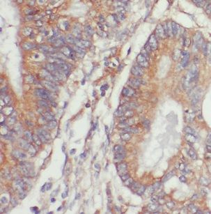 NET1 Antibody - BSA Free