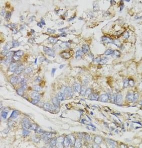 NDUFS7 Antibody - BSA Free