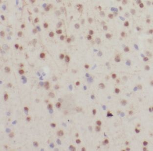 NDUFB7 Antibody - BSA Free