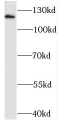 Sodium Calcium Exchanger 1/NCX1 Antibody - BSA Free