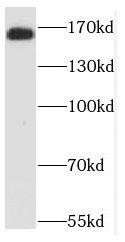 NCAPD3 Antibody - BSA Free