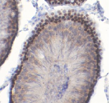 HOXA10 Antibody - BSA Free