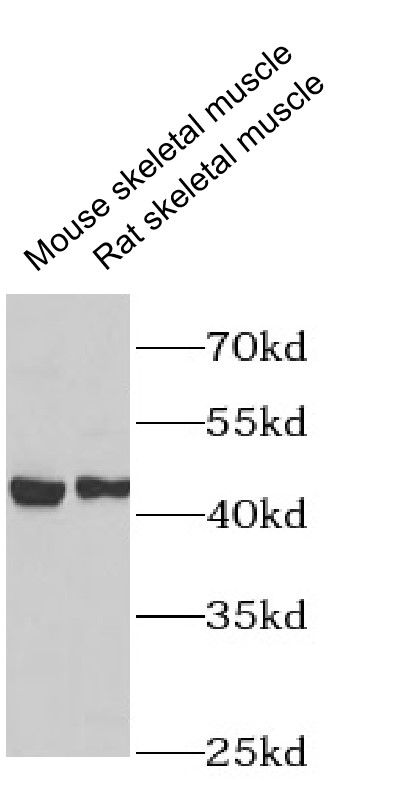 Nicotinic Acetylcholine Receptor epsilon Antibody - BSA Free