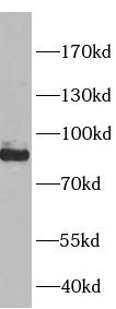 SLC26A3 Antibody - BSA Free
