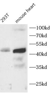 Complement Factor H-related 3/CFHR3 Antibody - BSA Free