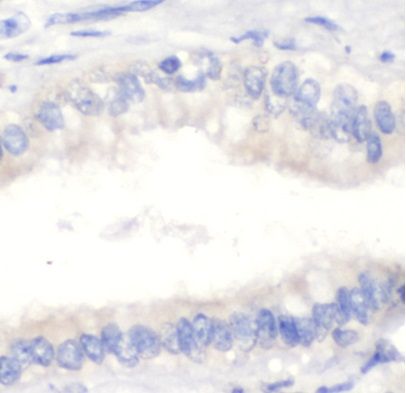 Complement Factor H-related 3/CFHR3 Antibody - BSA Free