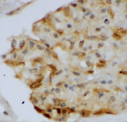 AKR1CL2 Antibody - BSA Free