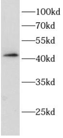 MAGEB18 Antibody - BSA Free