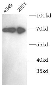 MAGED2 Antibody - BSA Free