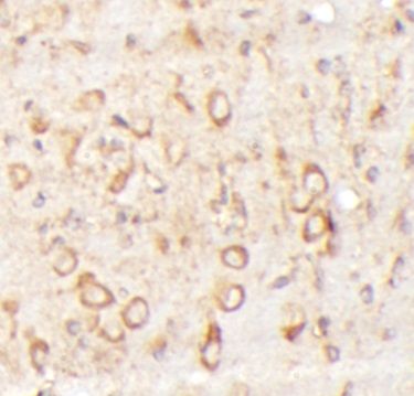 ZNF140 Antibody - BSA Free
