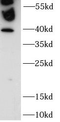 ZNF140 Antibody - BSA Free