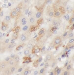 Galactosylceramidase/GALC Antibody - BSA Free