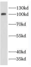 SLC12A9 Antibody - BSA Free