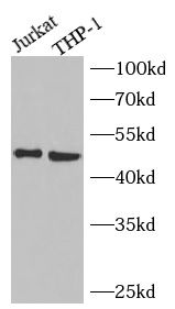 NEU3 Antibody - BSA Free