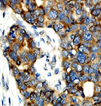 PGAM5 Antibody - BSA Free