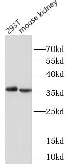 Aldo-keto Reductase 1B10/AKR1B10 Antibody - BSA Free