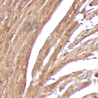 SCN7A Antibody - BSA Free