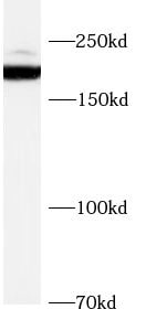 SCN7A Antibody - BSA Free