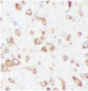 CPT1C Antibody - BSA Free