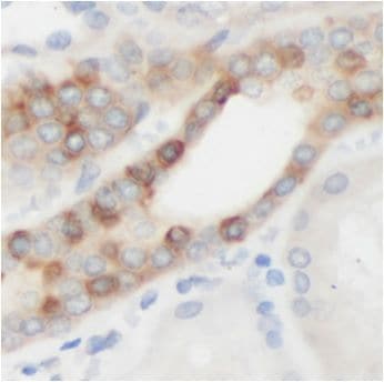 ACOXL Antibody - BSA Free