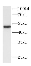 DDX25 Antibody - BSA Free