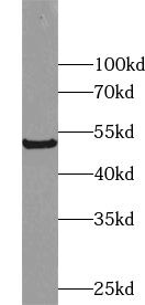 ZNF446 Antibody - BSA Free