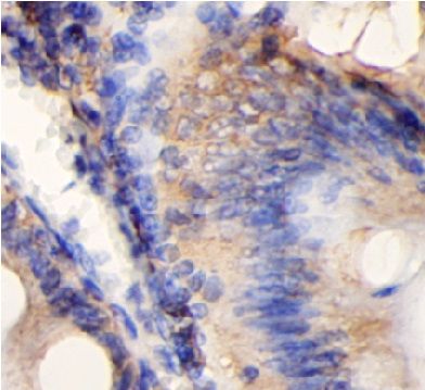 CHM Antibody - BSA Free