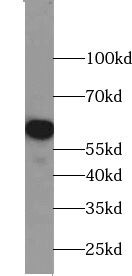 ZNF215 Antibody - BSA Free