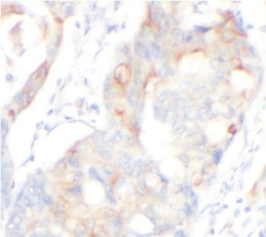 Hexokinase Type III Antibody - BSA Free