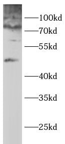 Glycogen synthase 2 Antibody - BSA Free
