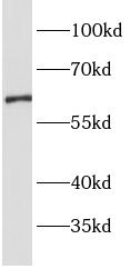OAT1 Antibody - BSA Free