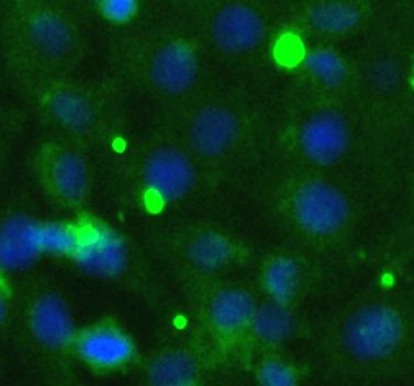 TRAM1 Antibody - BSA Free