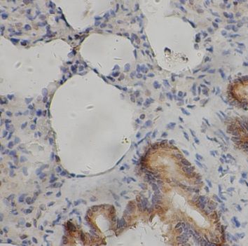Slap Antibody - BSA Free