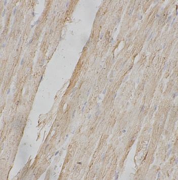 CLCN1 Antibody - BSA Free
