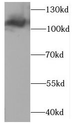 CLCN1 Antibody - BSA Free