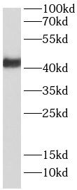 RNF34 Antibody - BSA Free