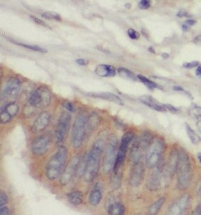 PTPN3 Antibody - BSA Free