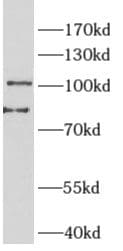 PTPN3 Antibody - BSA Free