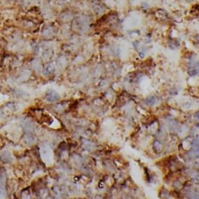 MED14 Antibody - BSA Free