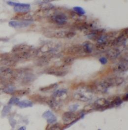 DNA2 Antibody - BSA Free