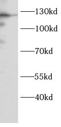 DNA2 Antibody - BSA Free