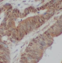 ABCA4 Antibody - BSA Free