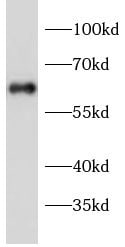 Collagen X alpha 1 Antibody - BSA Free