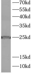 LMO1 Antibody - BSA Free