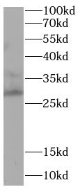 APOBEC3A Antibody - BSA Free