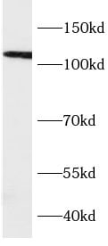 VPS39 Antibody - BSA Free